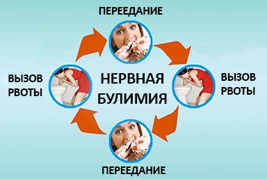 Лечение булимии в Ивангороде